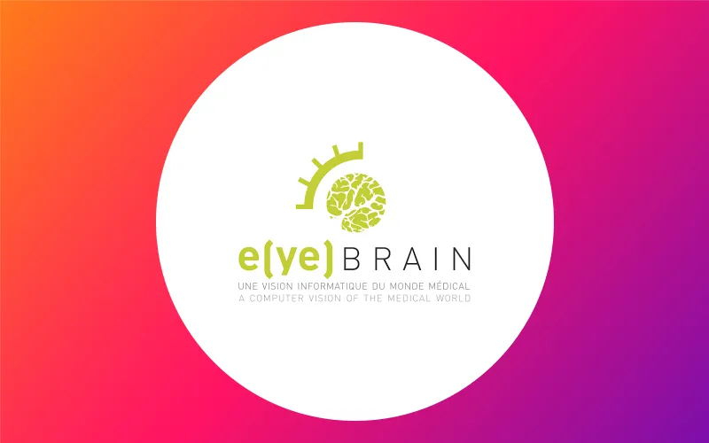 Eye Brain Actualité