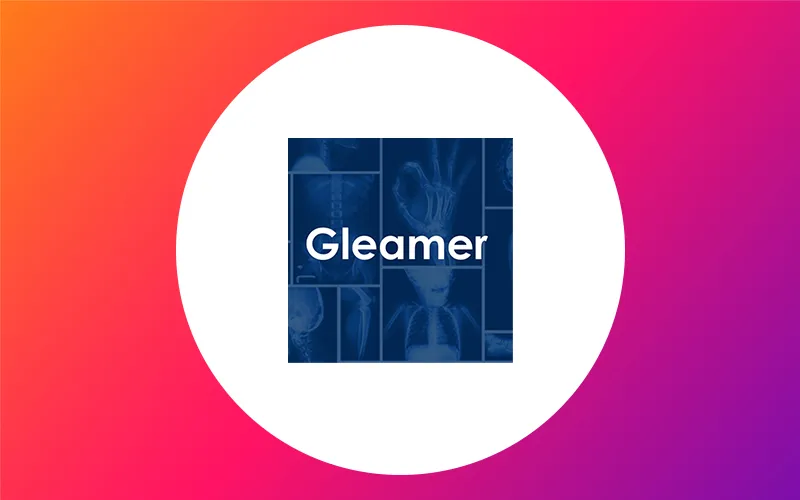 Gleamer Actualité